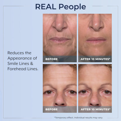 Plexaderm Rapid Reduction Serum - Visibly Reduces Under-Eye Bags & Wrinkles Instant eye serum that visibly reduces under-eye bags, puffiness, wrinkles & dark circles in minutes, lasting up to 10 hours